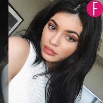 lip plum, lip augmentation