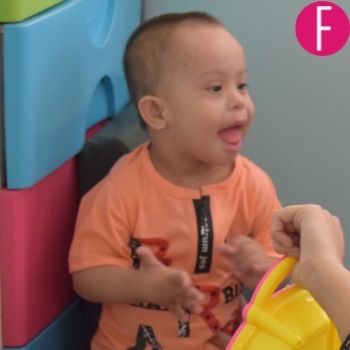 down syndrome