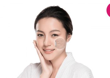 acne scar removal