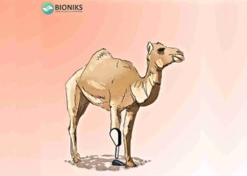 Bioniks To Transform Life Of Injured Cammie With Prosthetic Leg