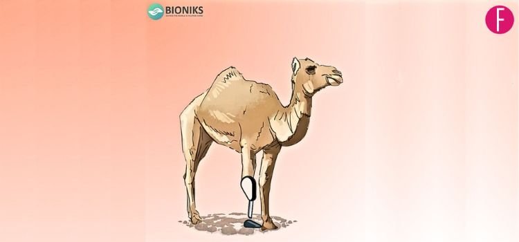 Bioniks To Transform Life Of Injured Cammie With Prosthetic Leg