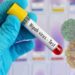 Nipah Virus Outbreak In India – Here’s Everything You Need To Know About It